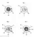 Fig. 02 - Variable appearance tissue markings