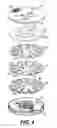 Fig. 05 - Inhaler
