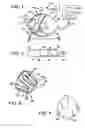 Fig. 02 - Breathing device