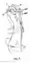 Fig. 05 - Forelimb brace device