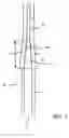 Fig. 04 - Plastic pressure vessel for a fluid and method of manufacturing such a vessel