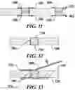 Fig. 06 - Method for repairing defects in a conductive substrate using welding
