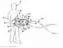 Fig. 01 - Toy water gun with variable spray patterns