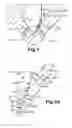 Fig. 02 - Injection nozzle