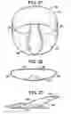 Fig. 15 - Lifting foil