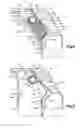 Fig. 04 - Support bracket for an inflatable curtain