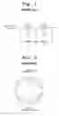 Fig. 02 - Deflection yoke for correcting misconvergence