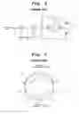 Fig. 04 - Deflection yoke for correcting misconvergence