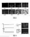 Fig. 03 - Electrophoretic display device