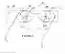 Fig. 02 - Bifocal spectacles for computer users