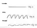 Fig. 09 - Apparatus and method for determining the viability of eggs