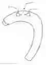 Fig. 01 - Real-ear zoom hearing device