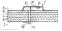 Fig. 01 - Joining element for releasable joining of partially overlapping parts, as well as a housing having such a joining element, and a method for releasable joining of at least partially overlapping parts