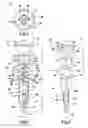 Fig. 02 - Anchor