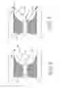Fig. 04 - Integral spark detector in fitting which supports igniter in gas turbine engine