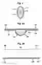Fig. 02 - Formulation for inhalation comprising a glucocorticoid and a beta 2-adrenoreceptor agonist