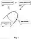 Fig. 02 -  Method and process for detecting a nail surface