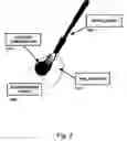 Fig. 03 -  Method and process for detecting a nail surface