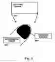 Fig. 04 -  Method and process for detecting a nail surface