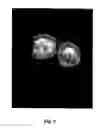 Fig. 09 - Saponins as anticancer agent