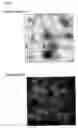 Fig. 02 - Vaccine composition comprising virus-like particles of human papillomavirus