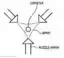 Fig. 01 - Highly lubricious hydrophilic coating utilizing dendrimers