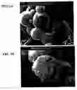 Fig. 03 - Drug delivery systems and use thereof