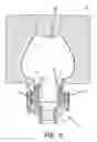 Fig. 06 - Nozzle for a blow molding machine