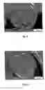 Fig. 04 - Method for producing foamed polymer molded bodies and said foamed polymer molder bodies