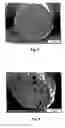Fig. 06 - Method for producing foamed polymer molded bodies and said foamed polymer molder bodies