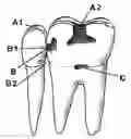 Fig. 01 - System for the controlled delivery of an active material to a dental site