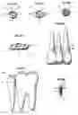 Fig. 03 - System for the controlled delivery of an active material to a dental site