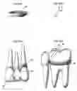 Fig. 06 - System for the controlled delivery of an active material to a dental site