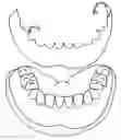 Fig. 01 - Cosmetic prosthesis