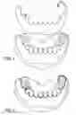 Fig. 02 - Cosmetic prosthesis