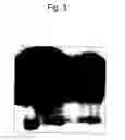 Fig. 04 - β-catenin oligonucleotide microchip and method for detecting β-catenin mutations employing same