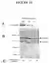 Fig. 20 - Genes encoding several poly(ADP-ribose) glycohydrolase (PARG) enzymes, the proteins and fragments thereof, and antibodies immunoreactive therewith