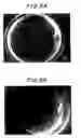 Fig. 04 - Method of handling an oocyte during in vitro fertilization