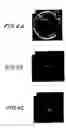 Fig. 05 - Method of handling an oocyte during in vitro fertilization