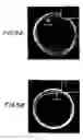 Fig. 06 - Method of handling an oocyte during in vitro fertilization