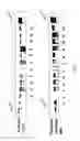 Fig. 02 - MTA1 is a predictive and prognostic factor in human breast cancer