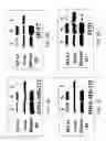 Fig. 03 - MTA1 is a predictive and prognostic factor in human breast cancer