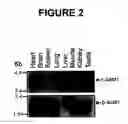 Fig. 03 - Regulation of gene expression by protein methylation