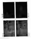 Fig. 04 - Compositions and methods relating to culturing neural stem cells with bone marrow stromal cells