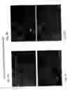 Fig. 05 - Compositions and methods relating to culturing neural stem cells with bone marrow stromal cells