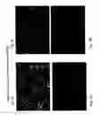 Fig. 06 - Compositions and methods relating to culturing neural stem cells with bone marrow stromal cells