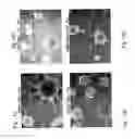 Fig. 17 - Compositions and methods relating to culturing neural stem cells with bone marrow stromal cells