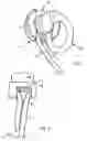 Fig. 06 - Connecting device for electrical connection of a socket of an electrical apparatus with a power cord plug