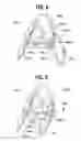 Fig. 07 - Free-standing jumping device