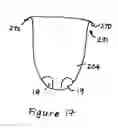 Fig. 18 - Orbital walker with activity table